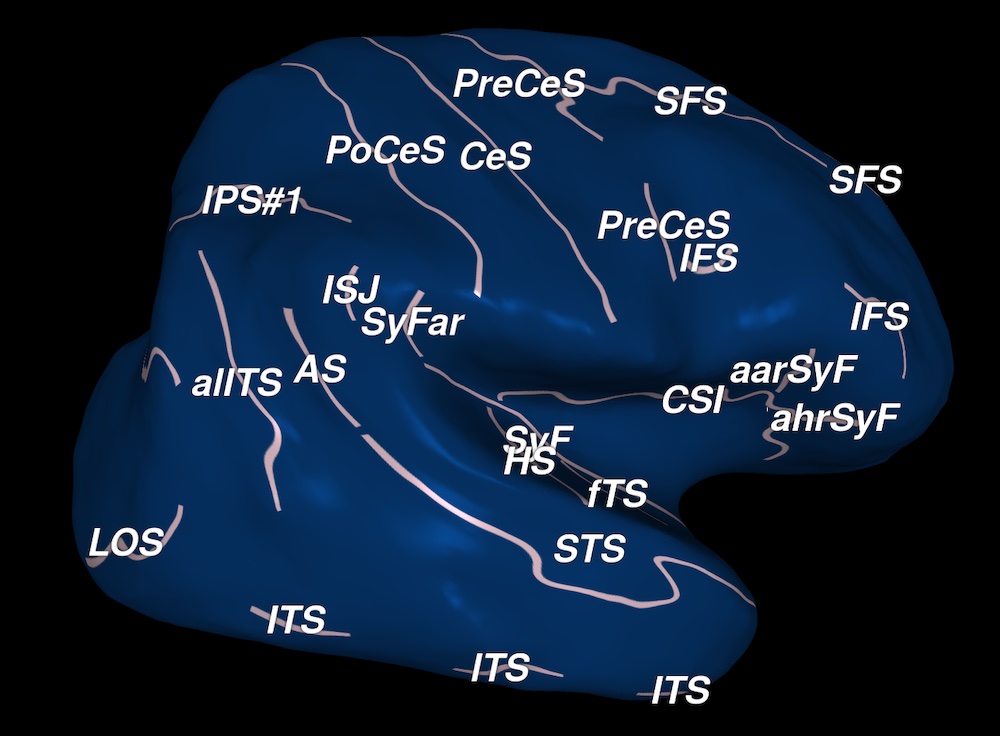 Sulci and Gyri