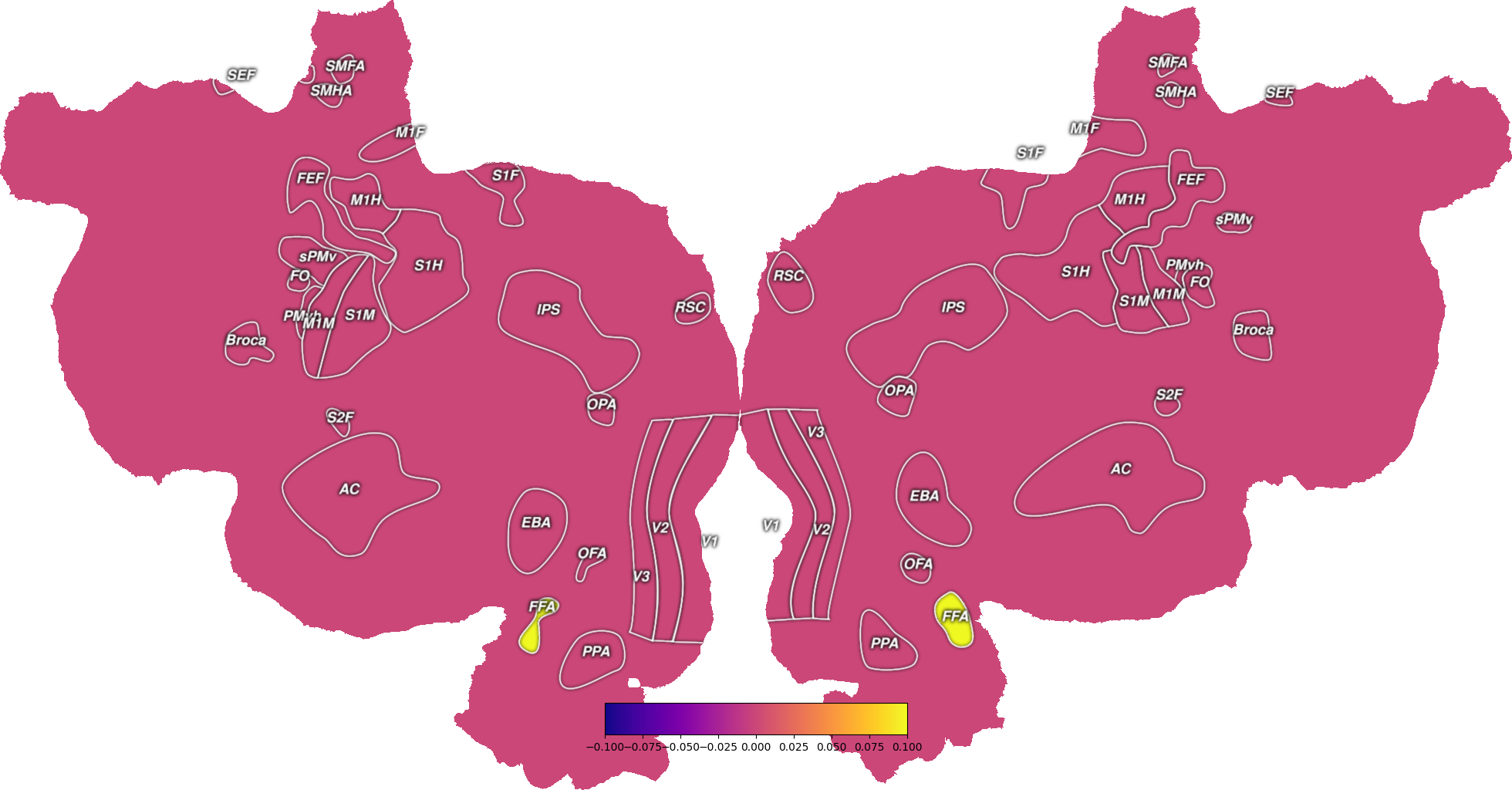 plot get roi vertices