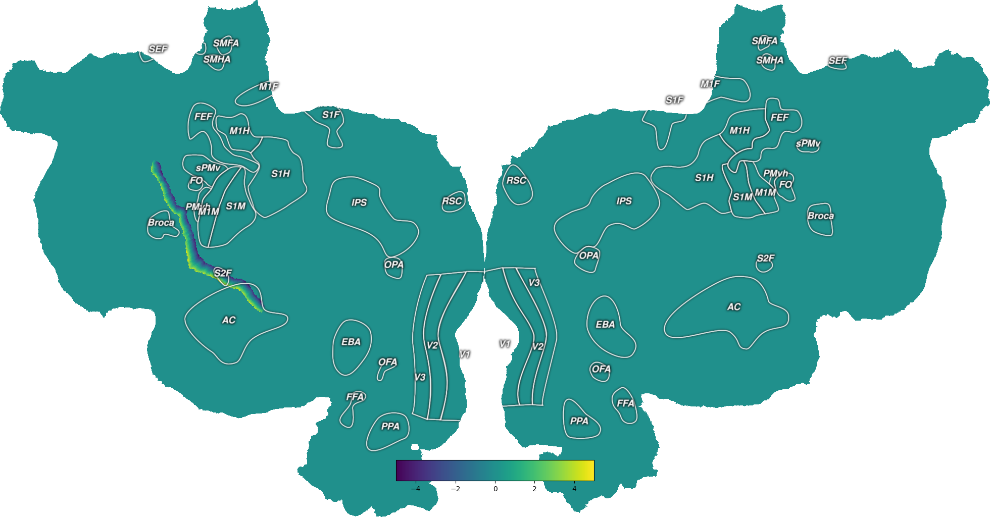 second coordinate, distance from central geodesic axis